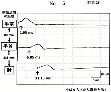 第61回午後問28画像