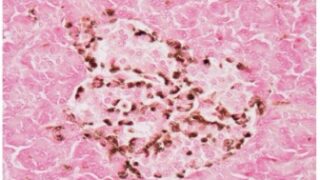 臨床検査技師国家試験ウラ解答 | 新卒も浪人生もわかりやすい