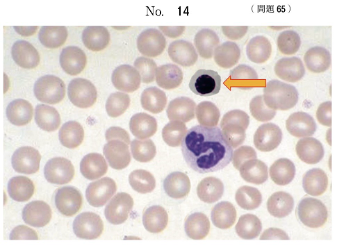 第72回問65の問題の画像(有核赤血球)
